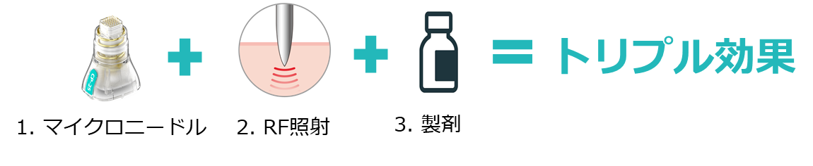 3つのポイント!