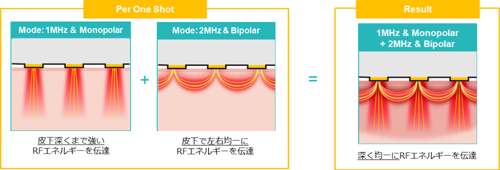 非侵襲治療(針で刺さない痛みの少ない治療)