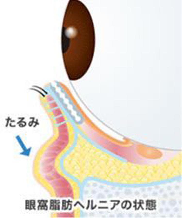 皮膚・腱や筋肉のゆるみ