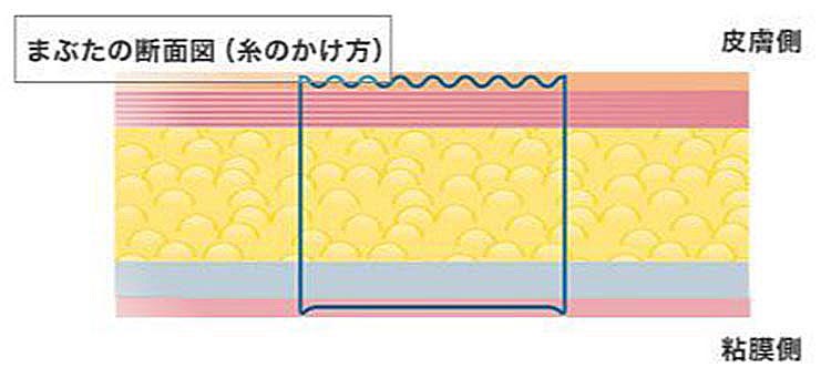 面（線）で固定しているため外れにくい。